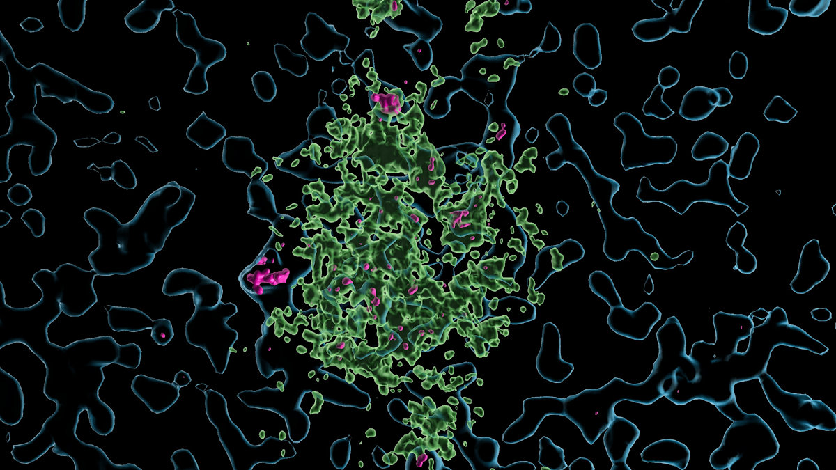 lbertiniielonkaoverroposal1