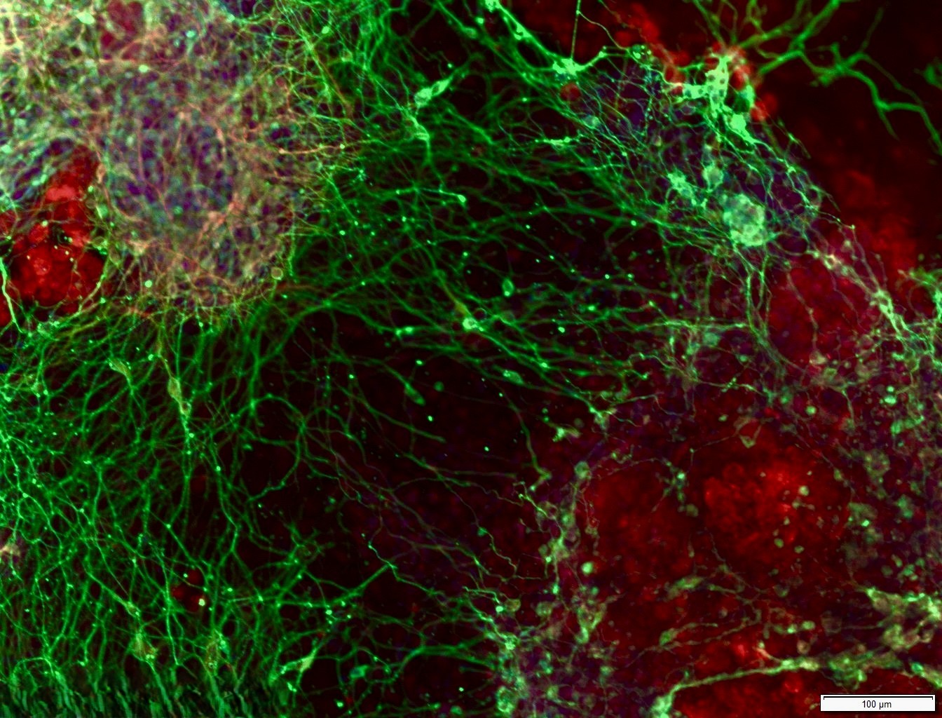 crispr neurons